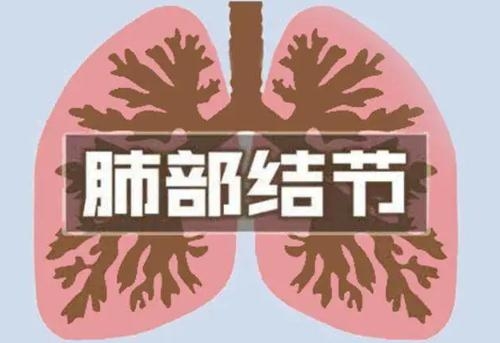 武汉好的肺结节医生钟明教授肺结节医案一则